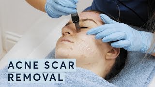 Playtube Pk Ultimate Video Sharing Website