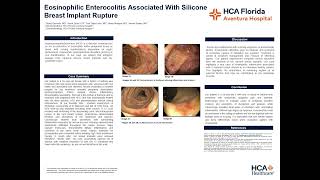 Eosinophilic Enterocolitis