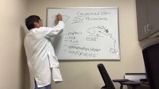 Cavernous Sinus and Superior Ophthalmic Vein Thrombosis