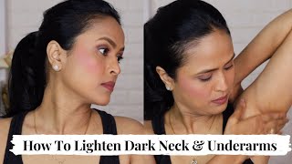 Get rid of dark neck \u0026 underarms in 30 days | Sanfe Spotlite Cream | Spotlite Sensitive Areas Serum