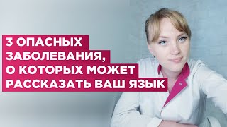 Что скрывает твой язык.