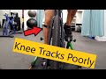 Knee pain from cycling due to poor tracking | The significance of a biomechanical assessment