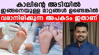 കാലിന്റെ അടിയിൽ ഇങ്ങനെയുള്ള മാറ്റങ്ങൾ ഉണ്ടെങ്കിൽ വരാനിരിക്കുന്ന അപകടം ഇതാണ്| healthy tips