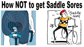 How NOT to get Saddle Sores & TREAT them if you do
