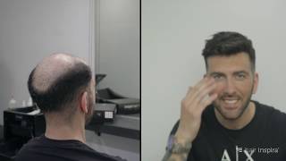 Antes y después de una prótesis capilar indetectable - Hair Inspira