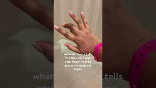 Finger amputation #fingersurgery  #benign #giantcelltumor #amputee #amputation #rayamputation