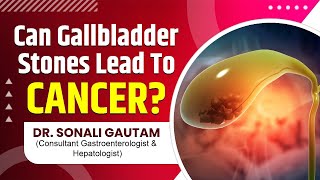 Can Gallbladder Stones Lead To CANCER? क्या पित्ताशय की पथरी से कैंसर हो सकता है? Dr. Sonali Gautam