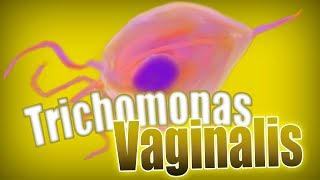 TRICOMONIASIS ⚠️: Trichomonas vaginalis. Clínica y tratamiento: metronidazol | Parasitología clínica