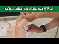 اسباب البراز الاخضر عند الرضع و علاجه | البراز الاخضر عند الرضع متي نطمئن و متي نخاف منه؟