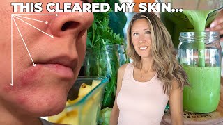 How I Cleared My Skin Naturally