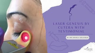 Laser Genesis by Cutera With Testimonial