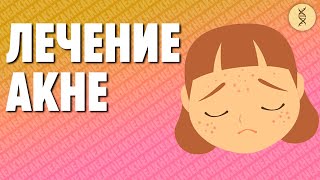 Избавиться от Акне: МЕДИЦИНА или ПИТАНИЕ?