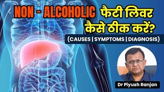 🔰(NAFLD) Non-Alcoholic Fatty Liver Disease in Hindi🔰|Symptoms/Treatment of Non-Alcoholic Fatty Liver
