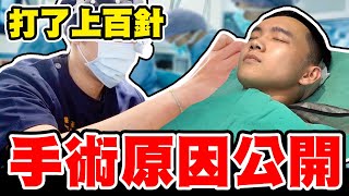 哲哲手術原因公開！打了上百針，術後整個人的變化是？【黃氏兄弟】