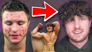 Top 10 Tips To AVOID ACNE While Working Out & Gaining Muscle!