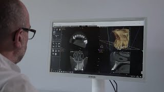 CS 9600 CBCT System – CS MAR with unique live comparison tool