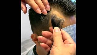 frontline hair patch #shorts #shortvideo #viral #youtubeshorts