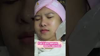 รีวิว #ฉีดแฟต #เหนี่ยง fat lipo serum สลายไขมันผิวหน้า หน้าเรียวภายใน 1 ชม.