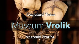 Museum Vrolik - Anatomy Stories 1: Conjoined Twins
