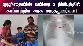 5 ரூபாய் நாணயத்தை விழுங்கிய குழந்தை - காப்பாற்றிய அரசு மருத்துவமனை மருத்துவர்கள்! | Govt Doctors