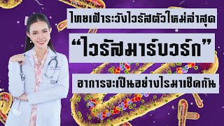 Ep.85: ไทยเฝ้าระวังไวรัสตัวใหม่ “ไวรัสมาร์บวร์ก”💥