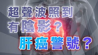 超聲波照到有陰影？ 係肝癌警號？醫學文獻點樣講? 1cm的腫瘤有幾多個癌細胞？