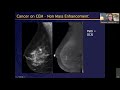 Breast Imaging Didactic Lecture | Dr. Carrie Rochman, MD