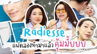 Radiesse ตัวดัง ดีจริงมั้ยย ลองให้แล้วนะ ที่ DSK Clinic