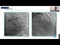 Webinar Series Topic 1 - Bifurcations, tortuosity and diffuse disease