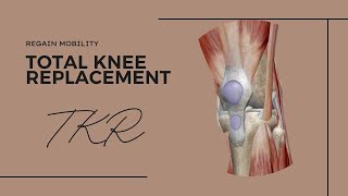 Regain mobility: Total Knee Replacement