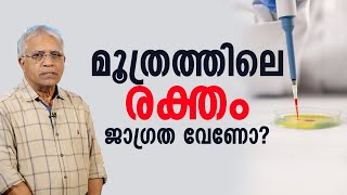 മൂത്രത്തിലെ രക്തം, ജാഗ്രത വേണോ?...