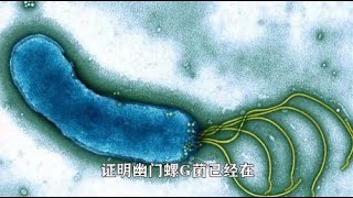 胃里有幽门螺杆菌，可尝试2个方法，或许能把细菌赶走