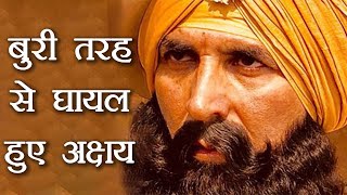 Akshay Kumar gets INJURED on the sets of KESARI while shooting ACTION sequence | FilmiBeat