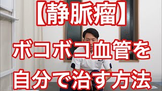 【静脈瘤を自分で治す】ふくらはぎのボコボコ血管を自分で治す方法をお伝えします