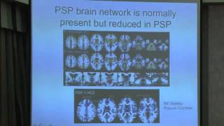 4 Progressive Supranuclear Paisy  | Atypical Parkinsonism (DLB, PSP, MSA, CBS/CBD) Symposium