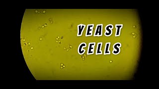 Yeast cells in stool routine Microscopy || @labmedicine9265