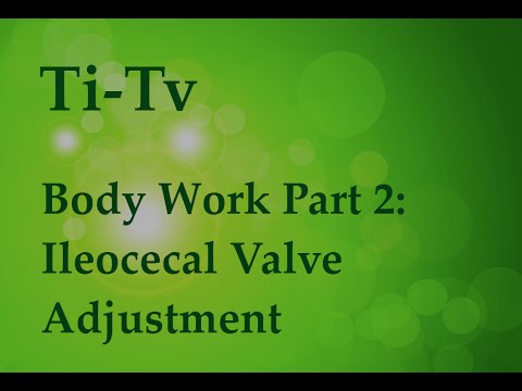 Body Work Part 2: Ileocecal Valve Adjustment Body Work Part 2: Ileocecal Valve Adjustment