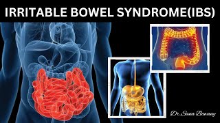 Irritable Bowel Syndrome IBS Symptoms and Homeopathic Treatment