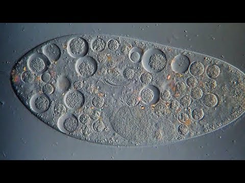 What kind of organism is a paramecium?