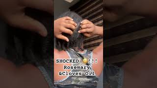 What Rosemary and Cloves oil did to my hair😳😱😱😱3m views #rosemary #hairgrowth