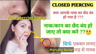 Help😔 ! My Nose Hole Closed Up नाक/कान का छेद बंद हो जाए तो क्या करे l Nose Piercing bump Treatment