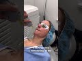 laser genesis wrinkle reduction u0026 skin tightening treatment gentle yag pro laser