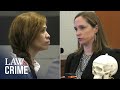 Knife, Saw Could Have Been Used to Decapitate Man: Forensic Anthropologist