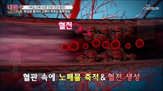 부실한 종아리 근육 → 「동맥경화」 유발 ⊙0⊙;;; [내 몸 플러스] 197회 20200517