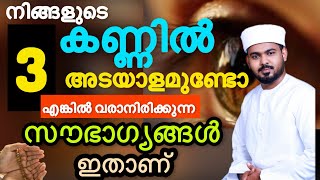 കണ്ണിൽ ഈ 3 അടയാളമുണ്ടോ? നിങ്ങളെ കാത്തിരിക്കുന്ന സൗഭാഗ്യങ്ങൾ വലുതാണ്