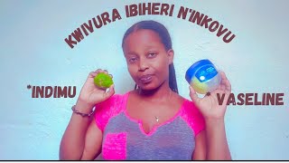 KWIVURA IBIHERI UKORESHEJE INDIMU NA VASELINE// How To Remove Pimples and Acne By lemon and Vaseline