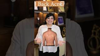 How to get rid of back acne? | Back acne treatment | Lacne Body Spray | Best der