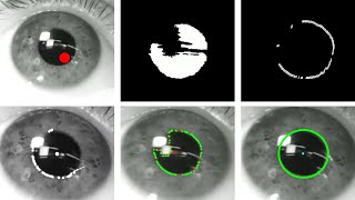 How Pupil Fitting Works in Eye Tracking Algorithms