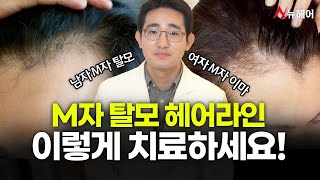 엠자탈모 엠자이마 헤어라인 이렇게 치료하세요ㅣ뉴헤어