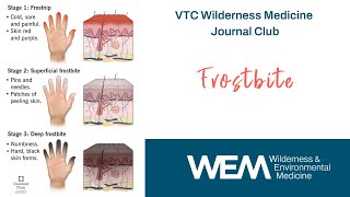 VTC Wilderness Medicine Journal Club: Frostbite